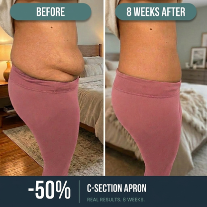 High-waisted postpartum shaping underwear