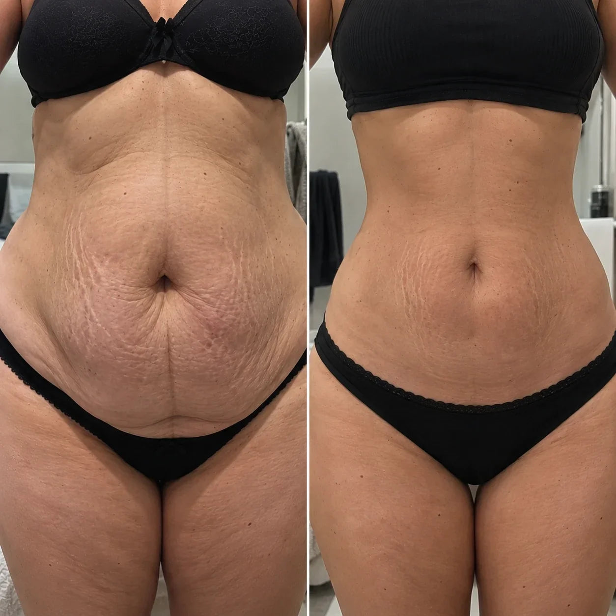 Emily before and after