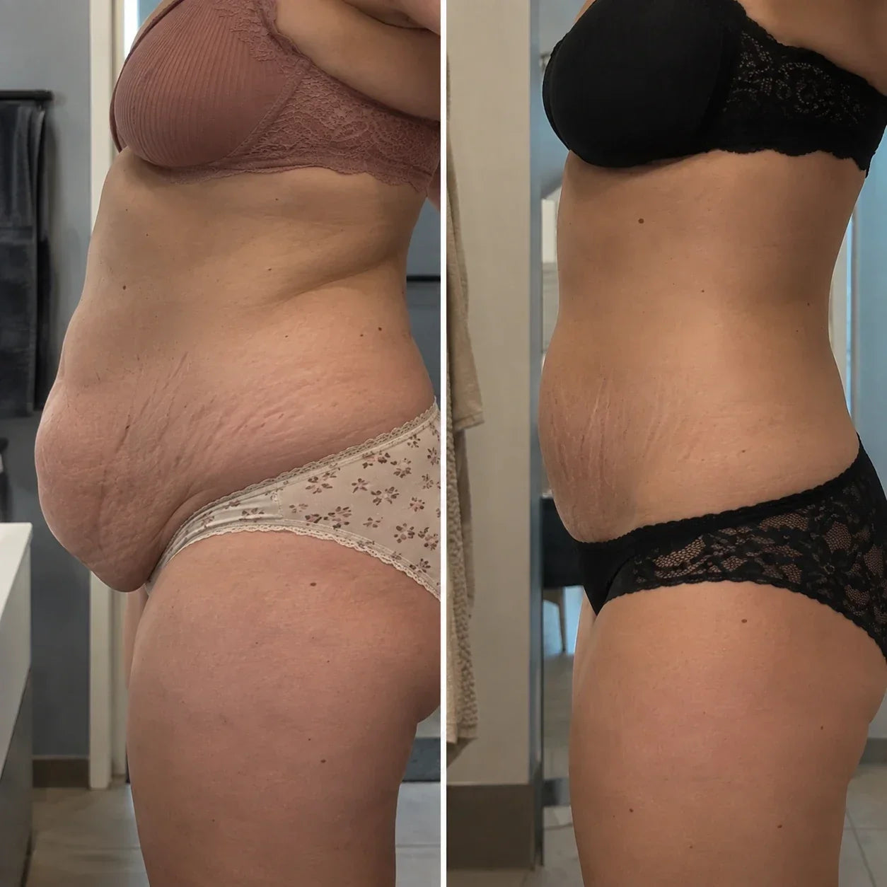 Jessica before and after