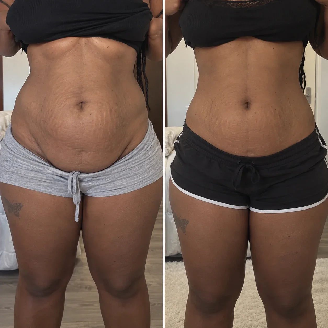 Ashley before and after