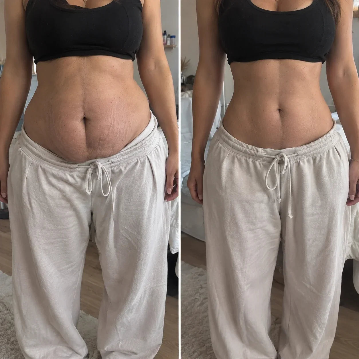 Lisa before and after